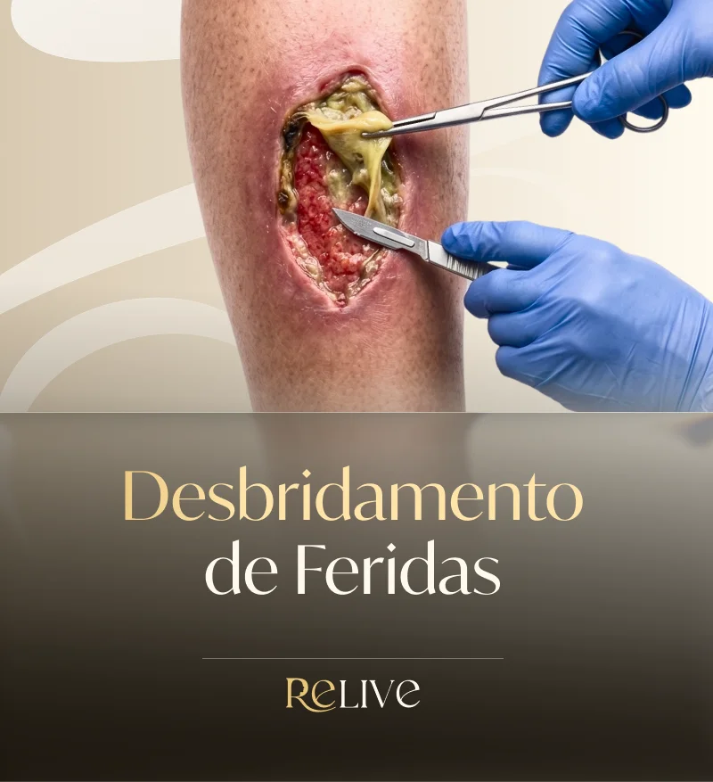 Desbridamento