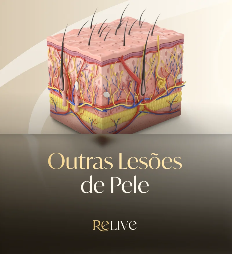 Outras Etiologias